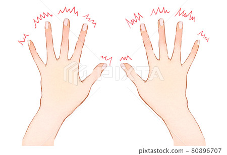 Illustration of numbness of fingertips and hands 80896707