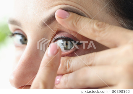 Young woman puts on contact lenses closeup Young woman puts on contact lenses closeup 80898563