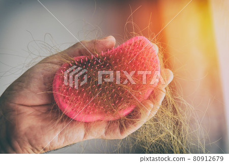 Hair loss problem brush with hair 80912679