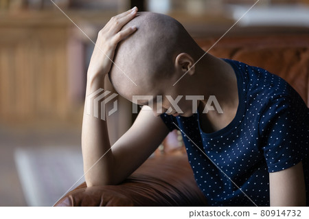 Frustrated young woman tired of cancer chemotherapy, feeling hopeless 80914732