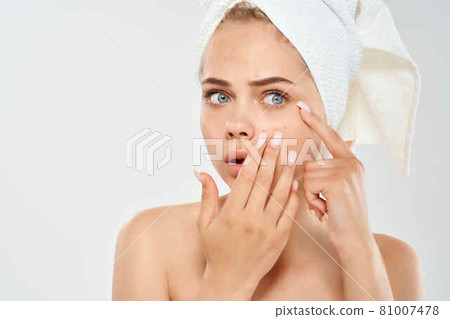 woman with towel on head health clean skin point on face 81007478
