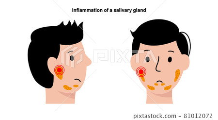 Salivary gland concept Salivary gland concept 81012072