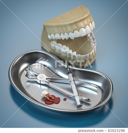 Dentist tools for dental care and human brace model. 81025296