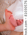 Comparison of baby and mother's foot size 81030576
