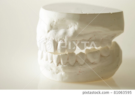 石膏牙模型牙齒圖像 81063595
