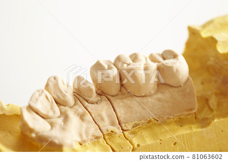 石膏牙模型牙齒圖像 81063602