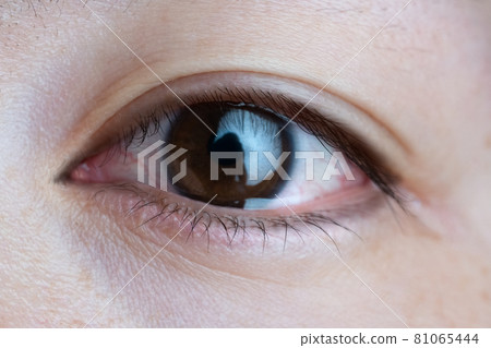 Front of female eyes Front of female eyes 81065444