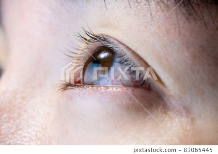 Female eyes seen from an angle Female eyes seen from an angle 81065445