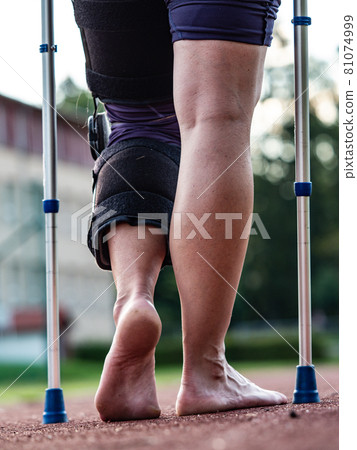 Hurt runner walk by crutches on track after competition 81074999
