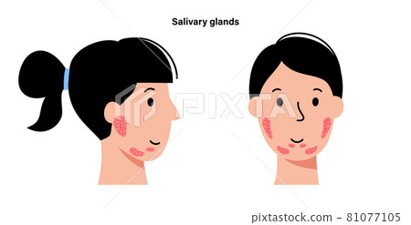 Salivary gland concept Salivary gland concept 81077105