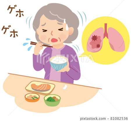 Aspiration: Elderly people who swallow during meals 81082536