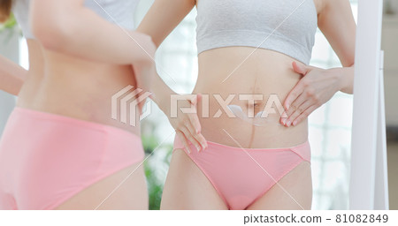 asian woman after giving birth asian woman after giving birth 81082849