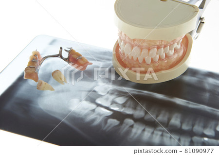 Partial denture bridge and X-ray photo Dental image 81090977