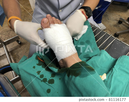 Surgeon making surgery operation on a man foot in hospital in operating room. Surgeon making surgery operation on a man foot in hospital in operating room. 81116177