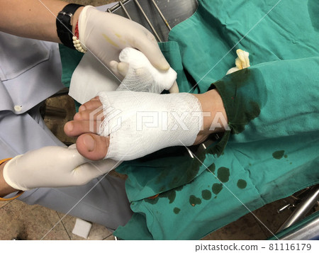 Surgeon making surgery operation on a man foot in hospital in operating room. Surgeon making surgery operation on a man foot in hospital in operating room. 81116179