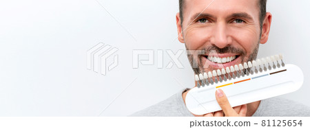 Smiling man with whitening shade guide 81125654