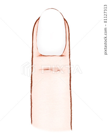 [White] Health condition that can be seen by the color of the nails 81127313