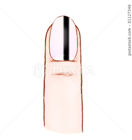 Illustration of nails and fingers with black lines Melanoma 81127348