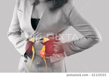 Stones in ureter. Stones in ureter. 81129101