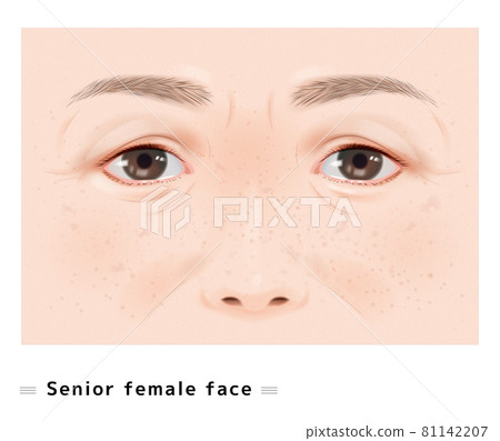 高級中年老人法律線鼻子污漬皺紋婦女臉開放老化真實例證 81142207