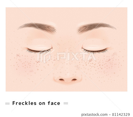 Freckles Skin Care Stain Female Face Eyes Nose Closed Real Illustration 81142329