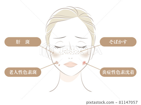 Types of stains 81147057