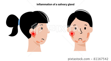 Salivary gland concept 81167542