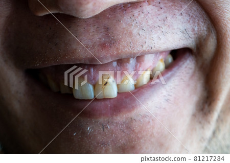 惡意的笑容(正面) 惡意的笑容(正面) 81217284