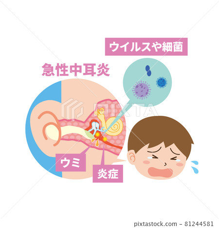 男孩因急性中耳炎哭泣 男孩因急性中耳炎哭泣 81244581