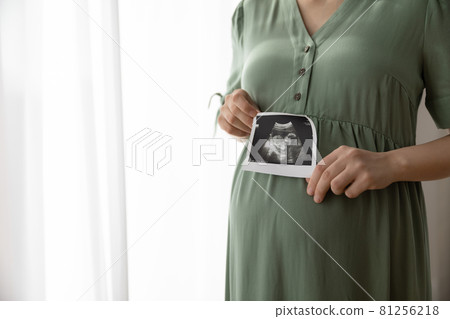 Pregnant woman showing unborn baby sonogram image at camera Pregnant woman showing unborn baby sonogram image at camera 81256218