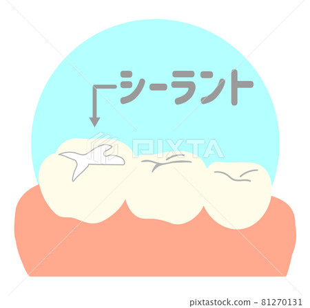 Sealant 81270131