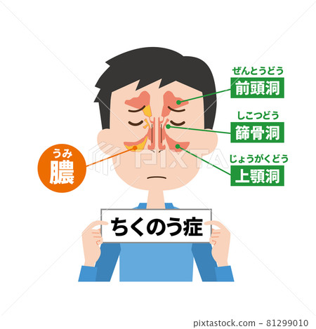 膿胸患者鼻子的內部圖像 膿胸患者鼻子的內部圖像 81299010