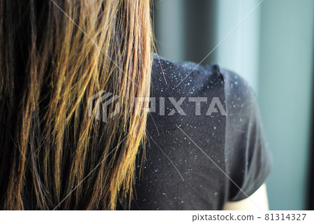 Rear view of woman having the dandruff on the shoulder Rear view of woman having the dandruff on the shoulder 81314327