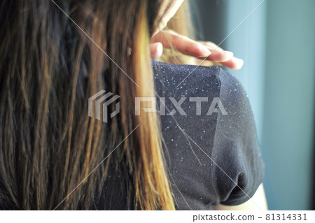 Rear view of woman having the dandruff on the shoulder Rear view of woman having the dandruff on the shoulder 81314331