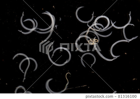 The study parasite or worms is a freshwater fish parasite in laboratory for education. The study parasite or worms is a freshwater fish parasite in laboratory for education. 81316100