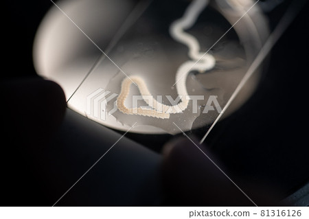 The study parasite or worms is a freshwater fish parasite in laboratory for education. 81316126