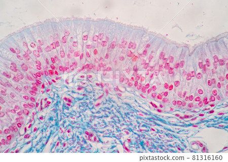 Characteristics of Columnar epithellum cell (Cell structure) of human under microscope view for education in laboratory. Characteristics of Columnar epithellum cell (Cell structure) of human under microscope view for education in laboratory. 81316160