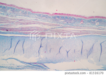 Characteristics of Columnar epithellum cell (Cell structure) of human under microscope view for education in laboratory. Characteristics of Columnar epithellum cell (Cell structure) of human under microscope view for education in laboratory. 81316170