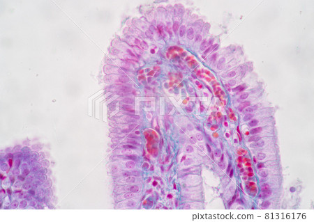 Characteristics of Columnar epithellum cell (Cell structure) of human under microscope view for education in laboratory. Characteristics of Columnar epithellum cell (Cell structure) of human under microscope view for education in laboratory. 81316176