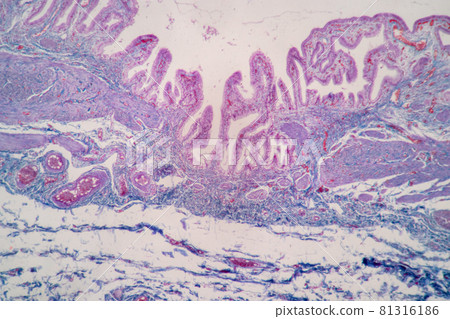 Characteristics of Columnar epithellum cell (Cell structure) of human under microscope view for education in laboratory. Characteristics of Columnar epithellum cell (Cell structure) of human under microscope view for education in laboratory. 81316186