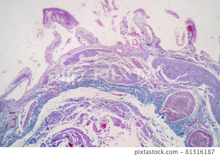 Characteristics of Columnar epithellum cell (Cell structure) of human under microscope view for education in laboratory. Characteristics of Columnar epithellum cell (Cell structure) of human under microscope view for education in laboratory. 81316187