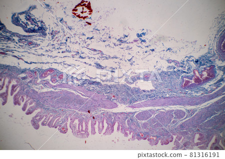 Characteristics of Columnar epithellum cell (Cell structure) of human under microscope view for education in laboratory. Characteristics of Columnar epithellum cell (Cell structure) of human under microscope view for education in laboratory. 81316191