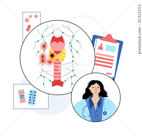 Thyroid cancer stages 81322253