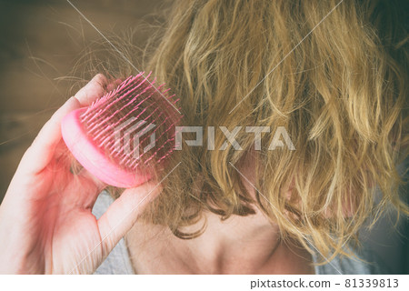 Hair loss problem brush with hair 81339813