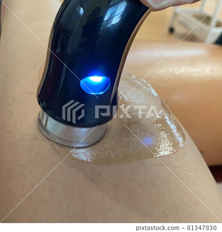 整骨診所的超聲波治療 81347830
