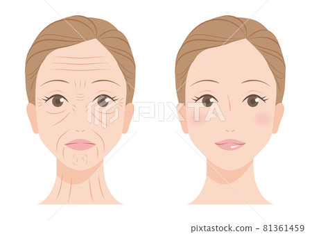 Wrinkles on a woman's face 81361459