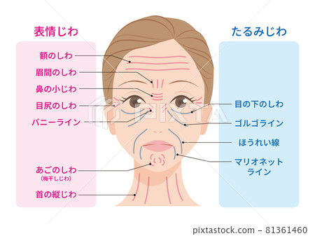 Wrinkle type Wrinkle type 81361460