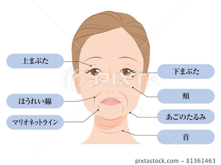 鬆弛的類型 81361463