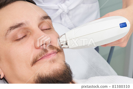 Man Having Laser Treatment At Beauty Clinic Man Having Laser Treatment At Beauty Clinic 81380310