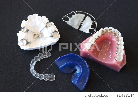 正畸矯治器 正畸矯治器 81458114